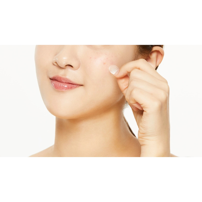 COSRX - AC Collection Acne Patch - Healing Eczema Patches with Centella Asiatica Extract - 26pcs - Image 4
